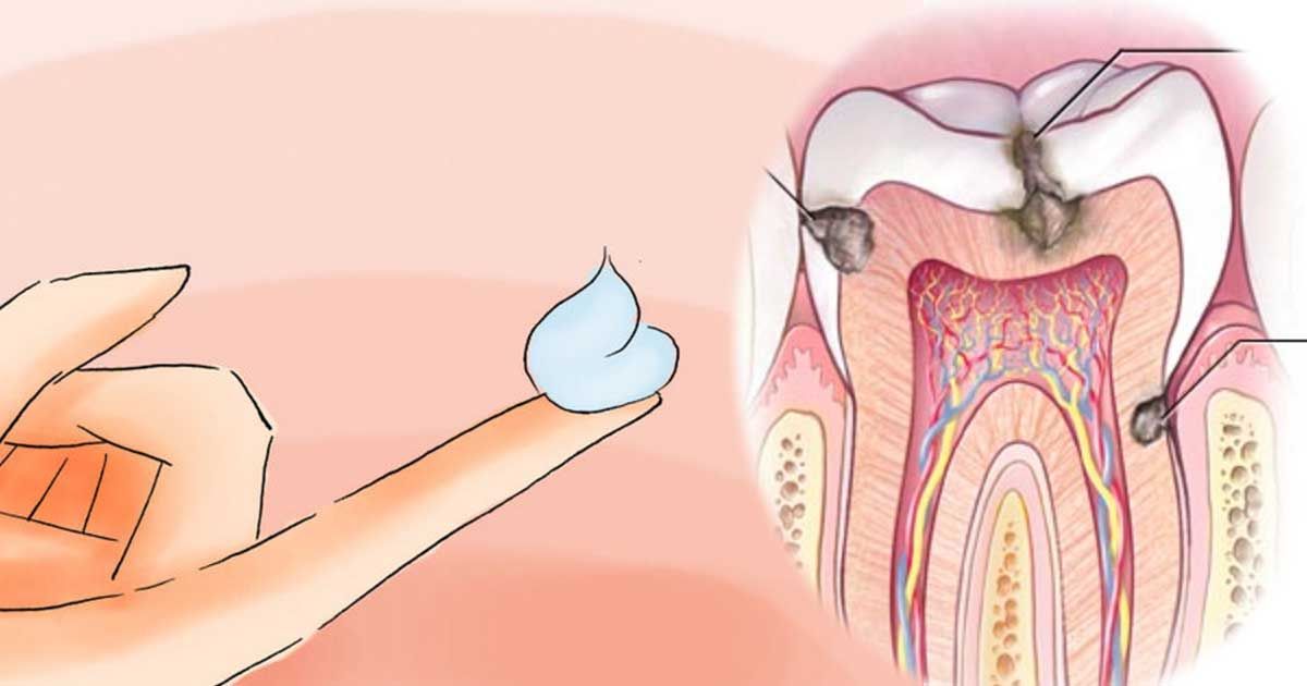 How to use coconut oil in your oral hygiene regimen