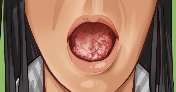 What The Tongue Says About Health 7 Pictures