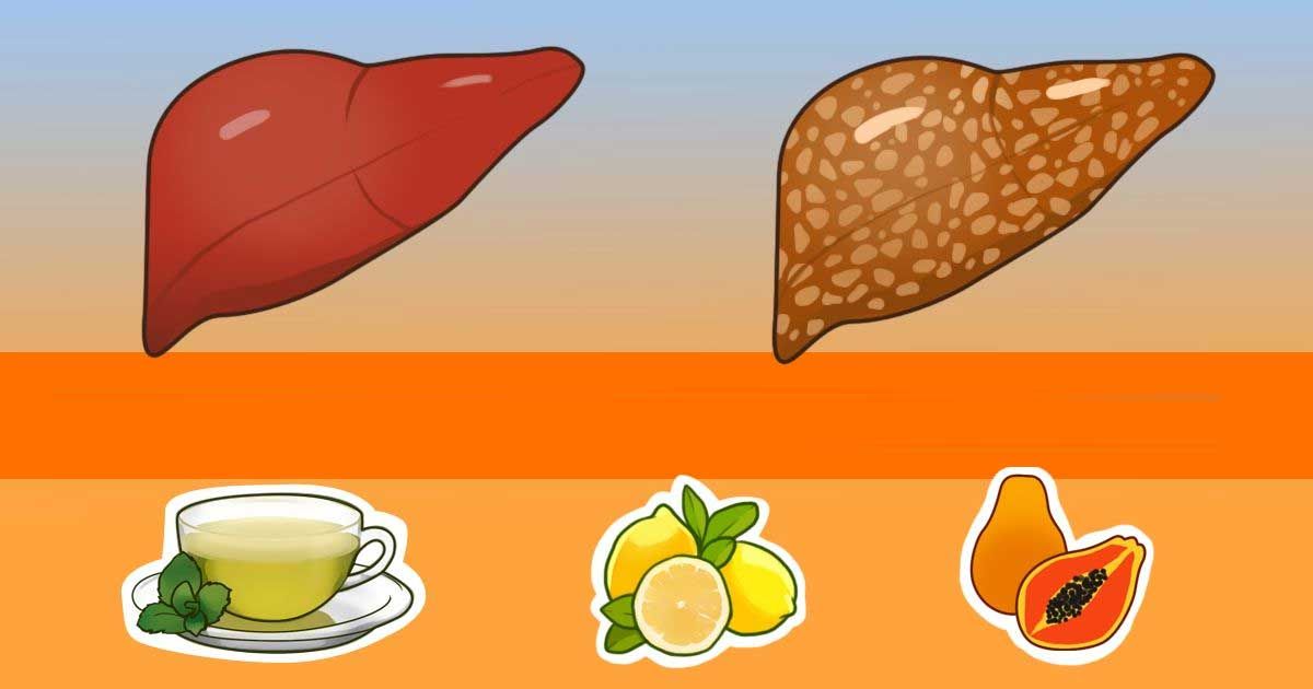 7+ early signs that you have a fatty liver and the natural ...