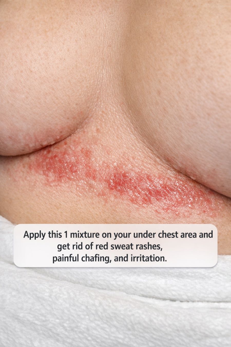 Apply this 1 mixture on your under chest area and get rid of red sweat ...