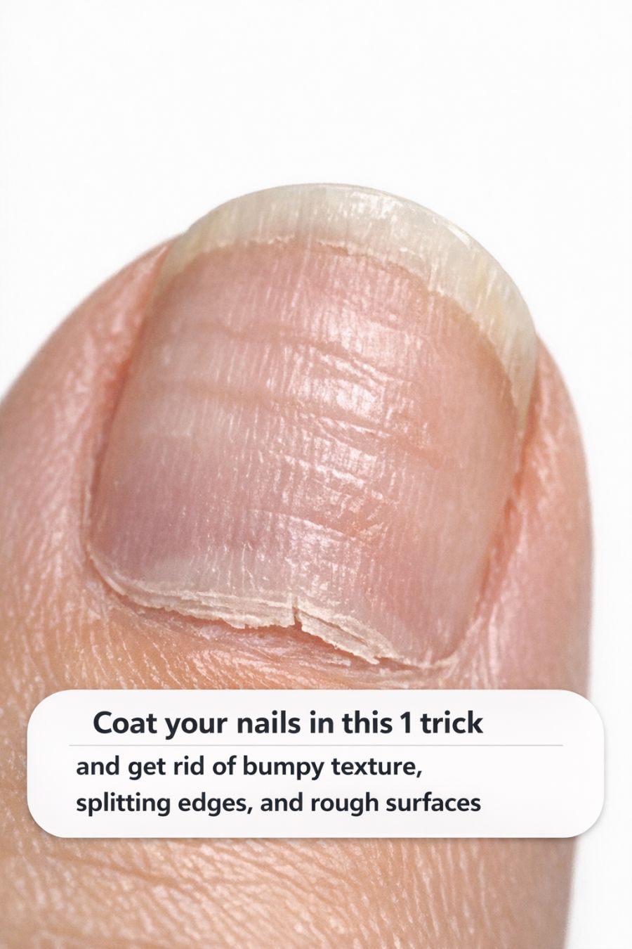 Coat your nails in this 1 trick and get rid of bumpy texture, splitting ...